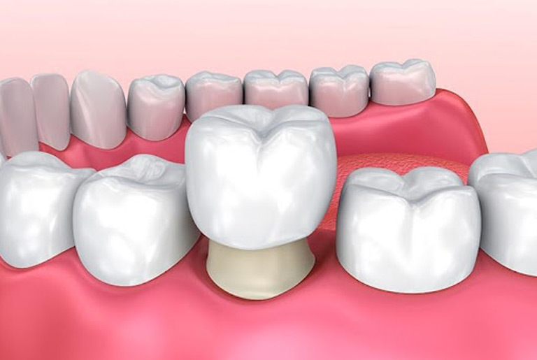 Restore tooth structure, restore your health.​